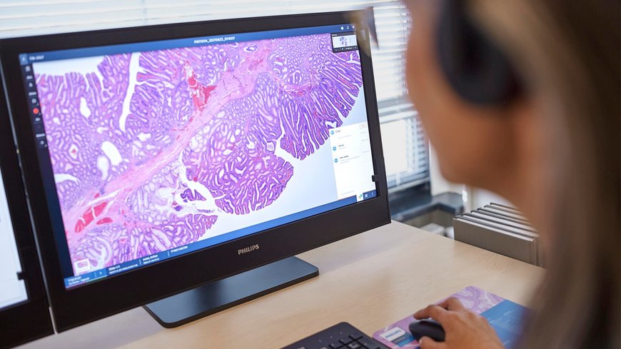 PHILIPS AND AWS COLLABORATE TO SCALE DIGITAL PATHOLOGY IN THE CLOUD